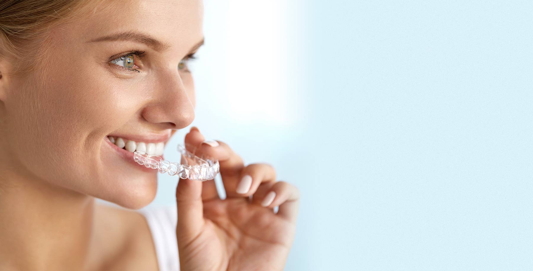 Invisible Braces Treatment