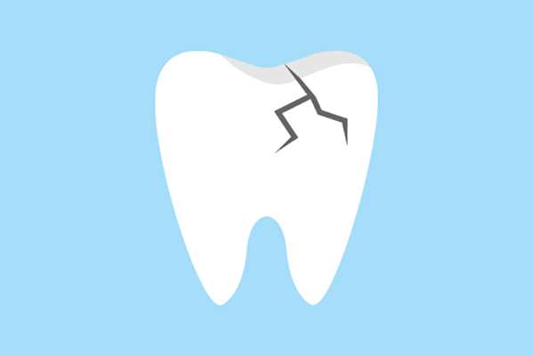 General Dentistry Treatments for a Damaged Tooth from Pacific View Smile Center in Santa Monica, CA