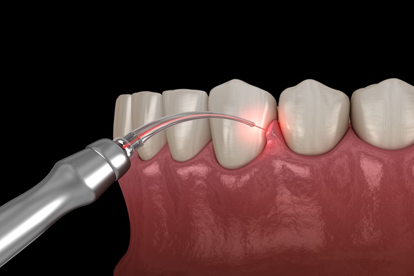 When Is Gum Disease Treatment Necessary?