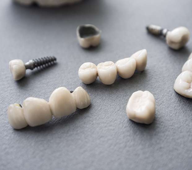 Santa Monica The Difference Between Dental Implants and Mini Dental Implants